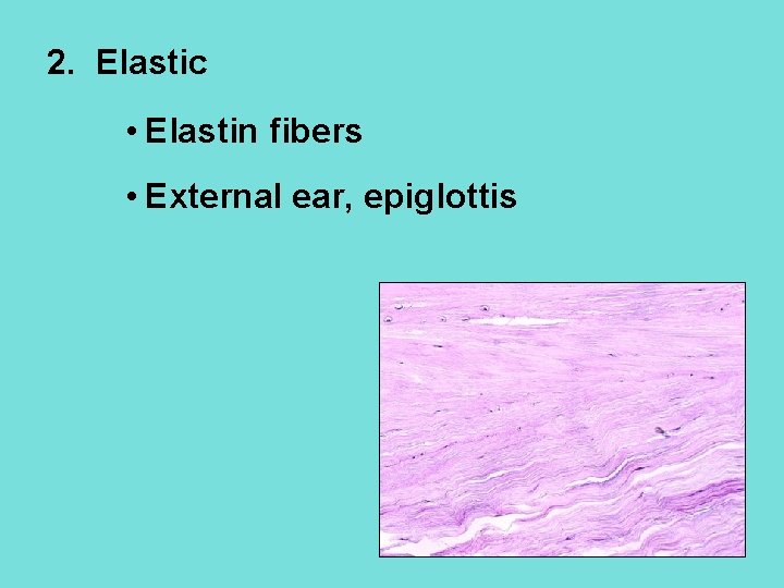 2. Elastic • Elastin fibers • External ear, epiglottis 