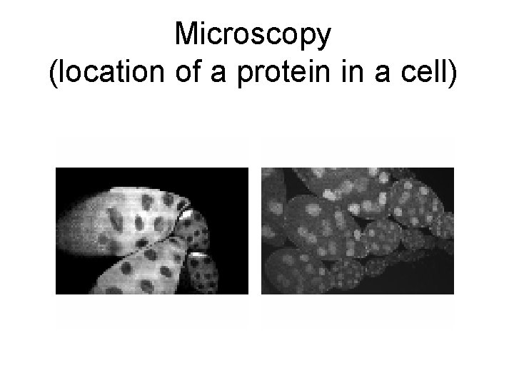 Microscopy (location of a protein in a cell) 