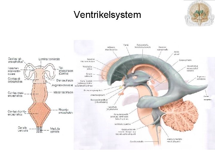 Ventrikelsystem Cornu occipitale 