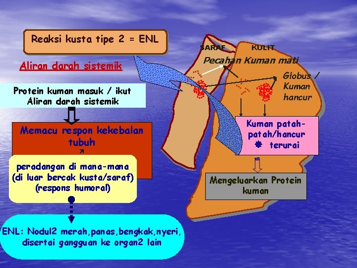 Reaksi kusta tipe 2 = ENL Aliran darah sistemik Protein kuman masuk / ikut