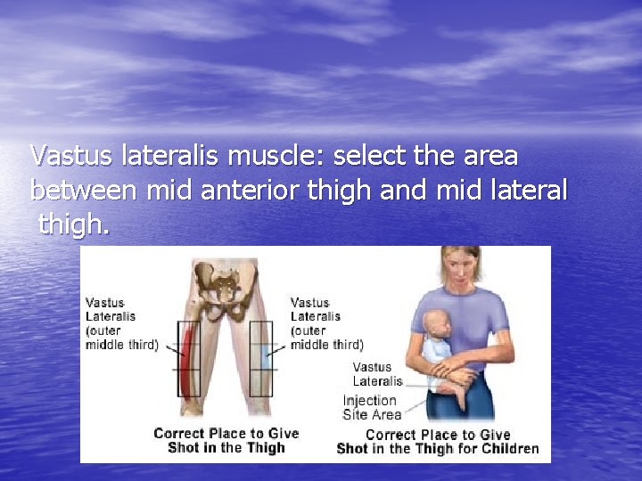 Vastus lateralis muscle: select the area between mid anterior thigh and mid lateral thigh.