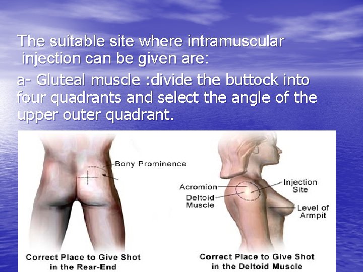 The suitable site where intramuscular injection can be given are: a- Gluteal muscle :