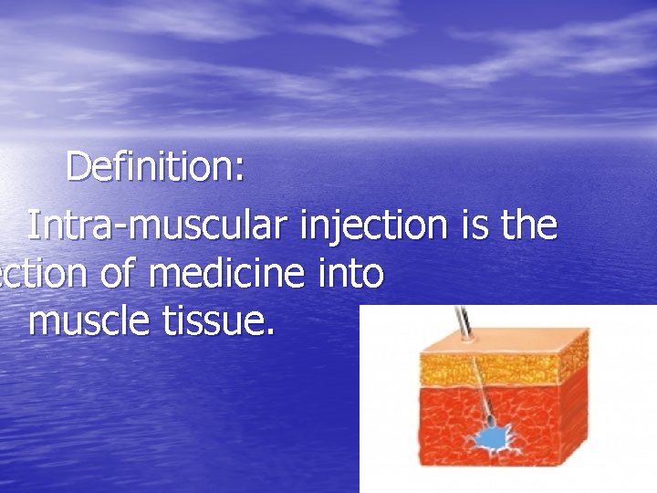 Definition: Intra-muscular injection is the ection of medicine into muscle tissue. 