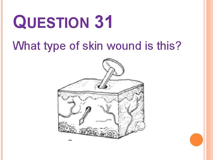 QUESTION 31 What type of skin wound is this? 