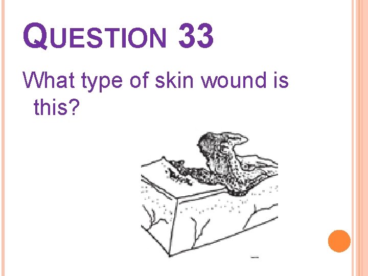 QUESTION 33 What type of skin wound is this? 