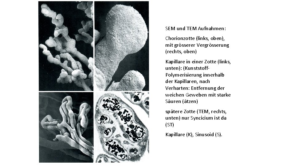SEM und TEM Aufnahmen: Chorionzotte (links, oben), mit grösserer Vergrösserung (rechts, oben) Kapillare in