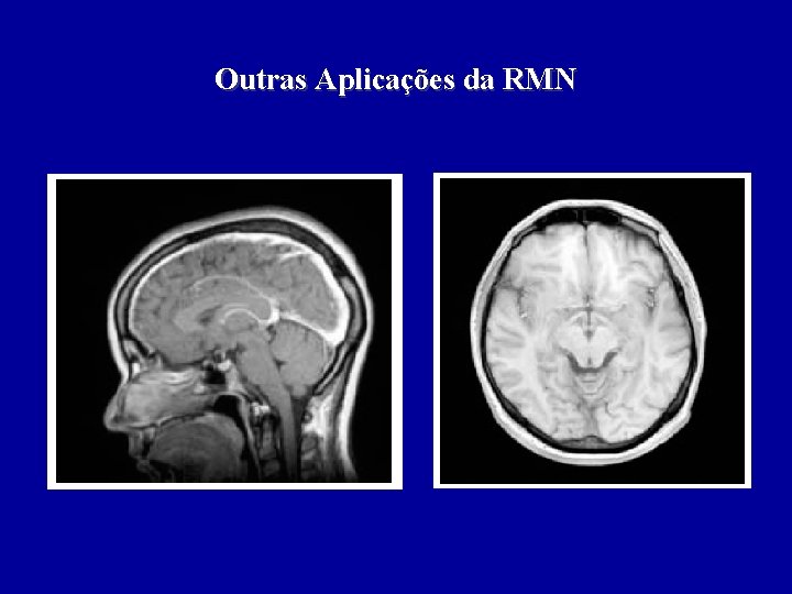 Outras Aplicações da RMN 