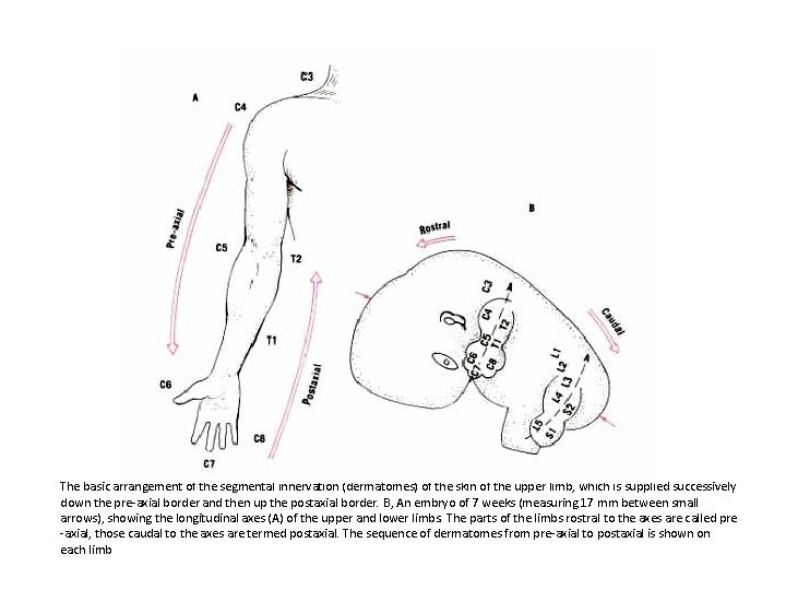 The basic arrangement of the segmental innervation (dermatomes) of the skin of the upper