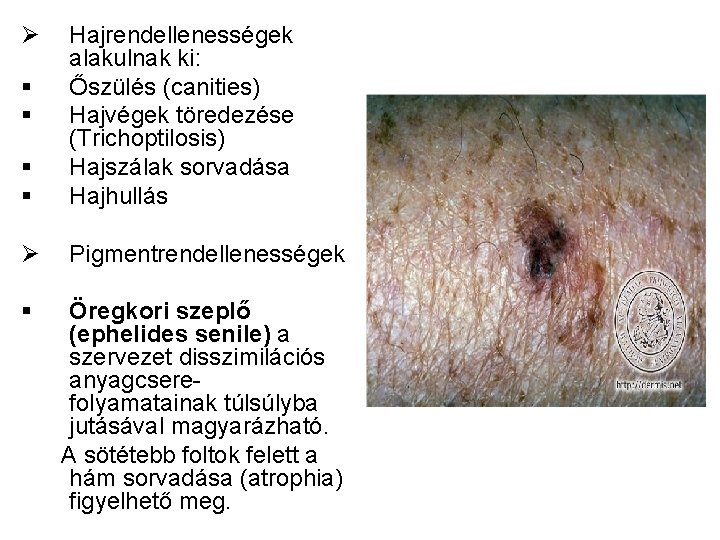 Ø § § Hajrendellenességek alakulnak ki: Őszülés (canities) Hajvégek töredezése (Trichoptilosis) Hajszálak sorvadása Hajhullás