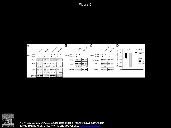 Figure 5 The American Journal of Pathology 2012 180831 -838 DOI: (10. 1016/j. ajpath.