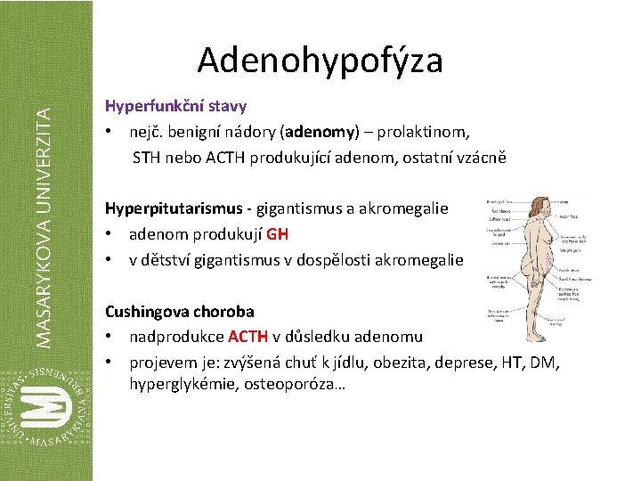 Adenohypofýza Hyperfunkční stavy • nejč. benigní nádory (adenomy) – prolaktinom, STH nebo ACTH produkující