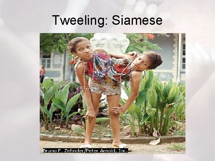 Tweeling: Siamese 