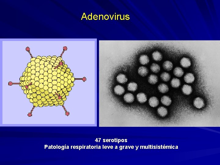 Adenovirus 47 serotipos Patología respiratoria leve a grave y multisistémica 