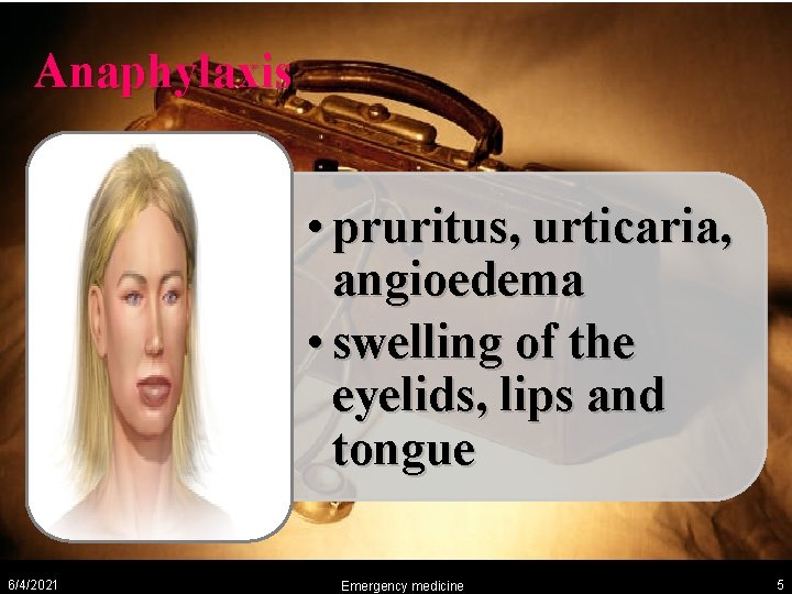 Anaphylaxis • pruritus, urticaria, angioedema • swelling of the eyelids, lips and tongue 6/4/2021