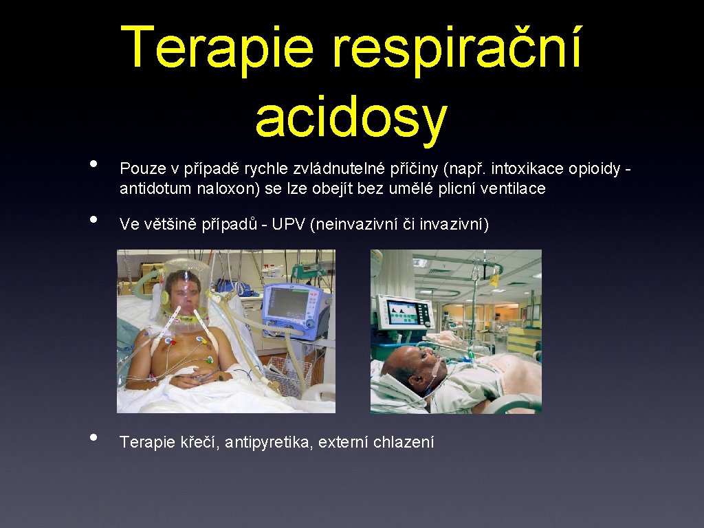  • Terapie respirační acidosy Pouze v případě rychle zvládnutelné příčiny (např. intoxikace opioidy