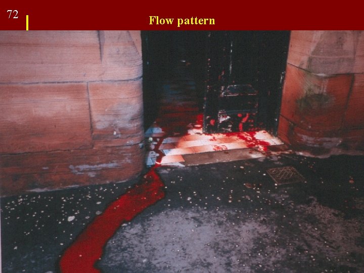 72 Flow pattern FORENSIC SCIENCE: An Introduction, 2 nd ed. By Richard Saferstein ©