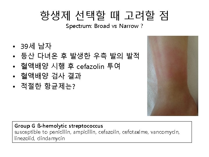 항생제 선택할 때 고려할 점 Spectrum: Broad vs Narrow ? • • • 39세