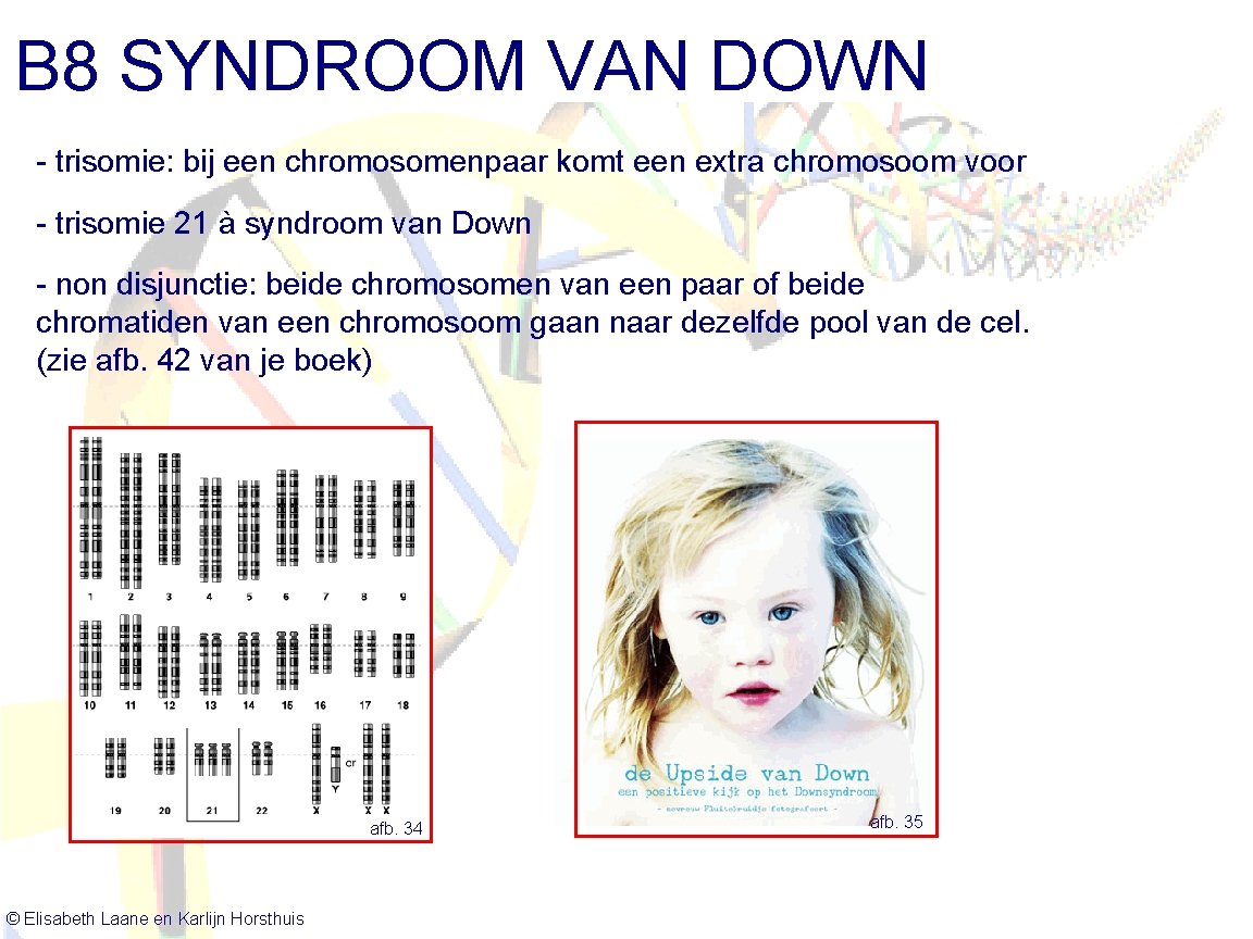 B 8 SYNDROOM VAN DOWN - trisomie: bij een chromosomenpaar komt een extra chromosoom