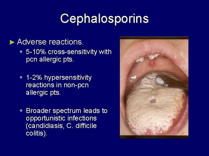 Cephalosporins ► Adverse reactions. § 5 -10% cross-sensitivity with pcn allergic pts. § 1
