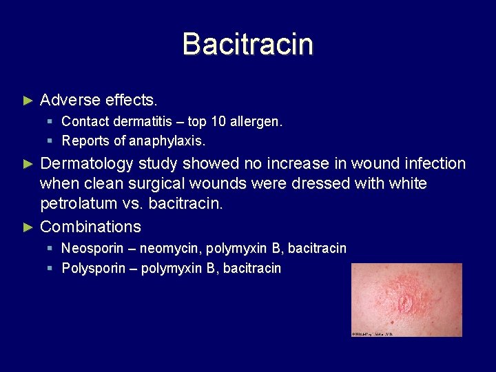 Bacitracin ► Adverse effects. § Contact dermatitis – top 10 allergen. § Reports of