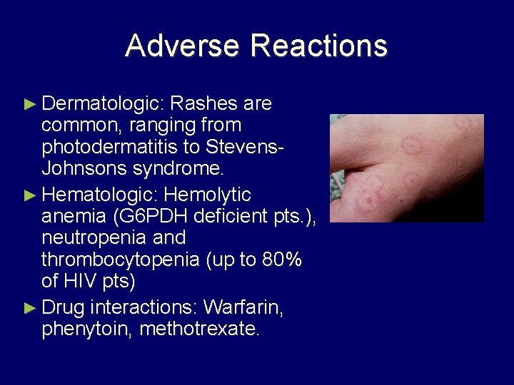 Adverse Reactions ► Dermatologic: Rashes are common, ranging from photodermatitis to Stevens. Johnsons syndrome.