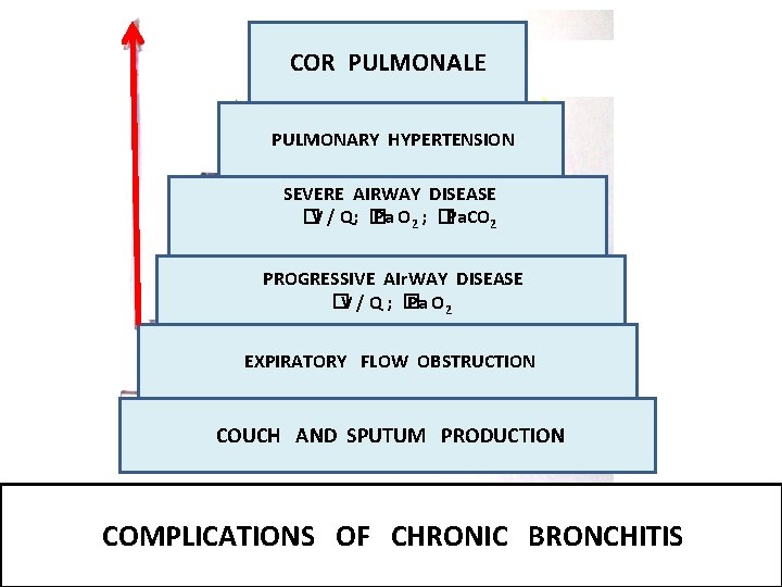 COR PULMONALE PULMONARY HYPERTENSION SEVERE AIRWAY DISEASE �V / Q; � Pa O 2