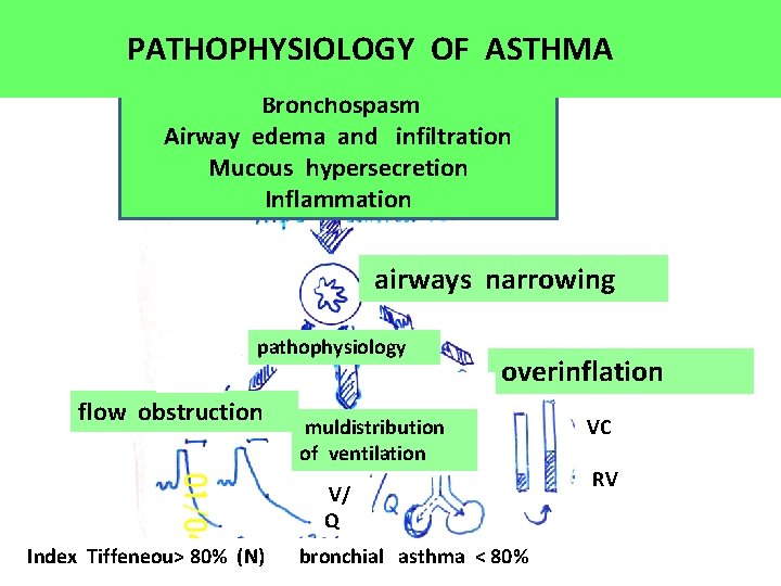 PATHOPHYSIOLOGY OF ASTHMA Bronchospasm Airway edema and infiltration Mucous hypersecretion Inflammation airways narrowing pathophysiology