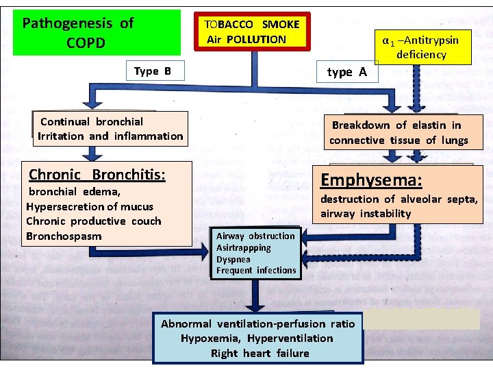 Pathogenesis of COPD TOBACCO SMOKE Air POLLUTION type A Type B Continual bronchial Irritation