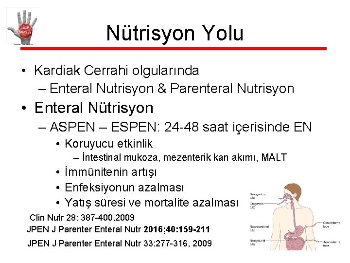 Nütrisyon Yolu • Kardiak Cerrahi olgularında – Enteral Nutrisyon & Parenteral Nutrisyon • Enteral