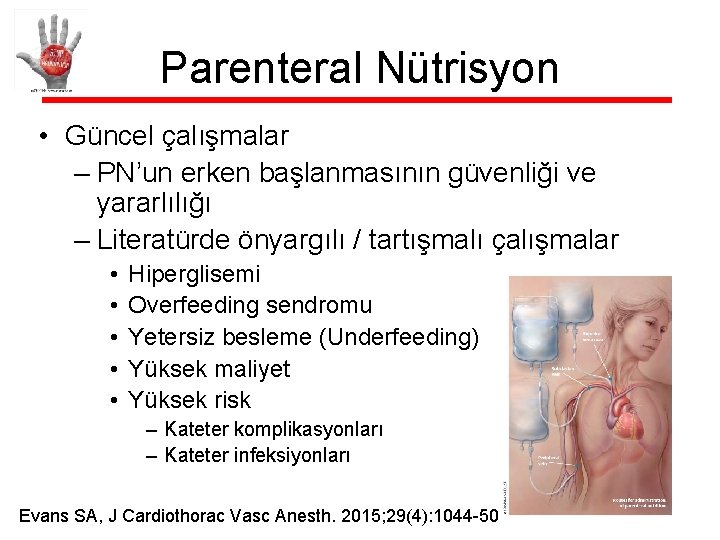 Parenteral Nütrisyon • Güncel çalışmalar – PN’un erken başlanmasının güvenliği ve yararlılığı – Literatürde