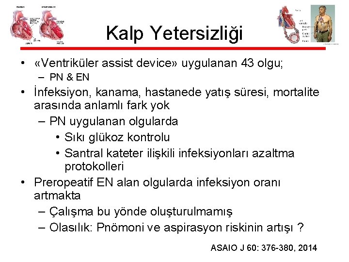 Kalp Yetersizliği • «Ventriküler assist device» uygulanan 43 olgu; – PN & EN •