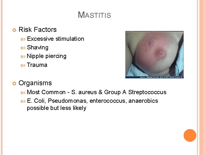 MASTITIS Risk Factors Excessive stimulation Shaving Nipple piercing Trauma Organisms Most Common - S.