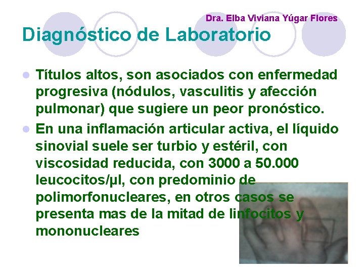 Dra. Elba Viviana Yúgar Flores Diagnóstico de Laboratorio Títulos altos, son asociados con enfermedad