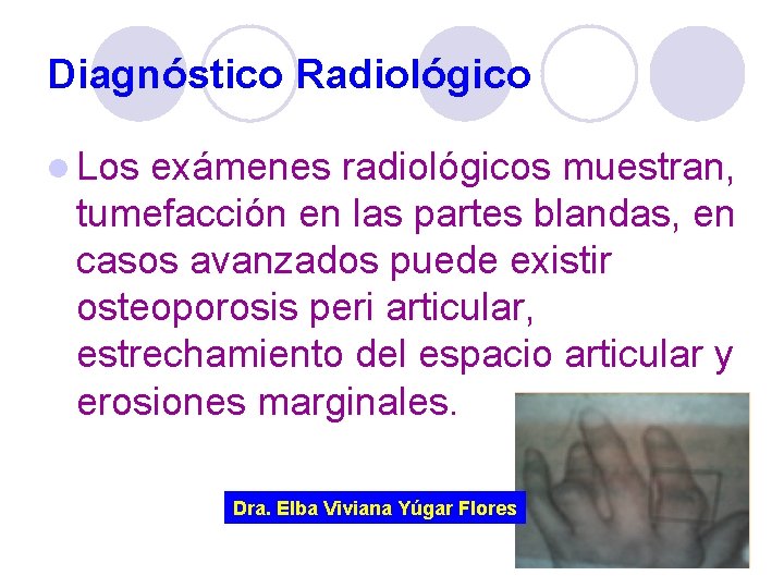 Diagnóstico Radiológico l Los exámenes radiológicos muestran, tumefacción en las partes blandas, en casos