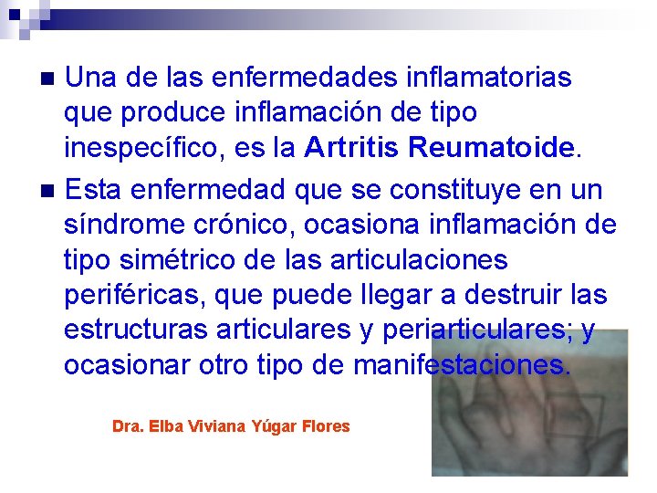 Una de las enfermedades inflamatorias que produce inflamación de tipo inespecífico, es la Artritis