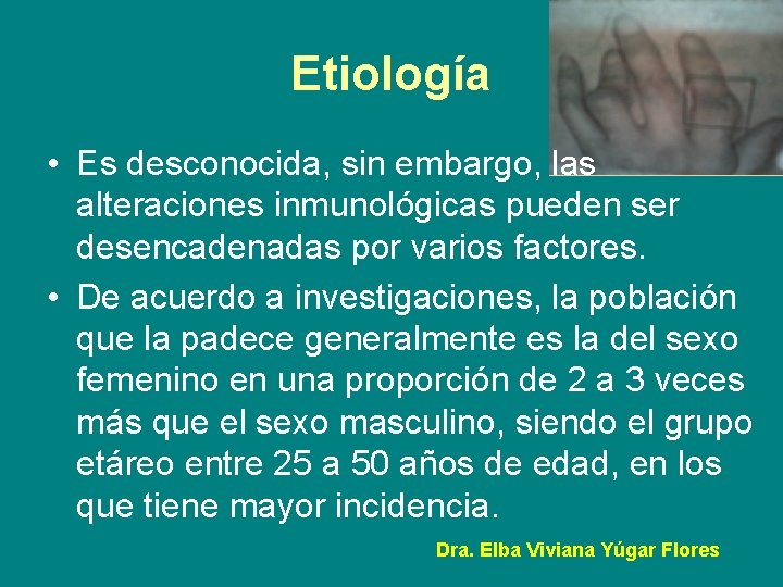 Etiología • Es desconocida, sin embargo, las alteraciones inmunológicas pueden ser desencadenadas por varios