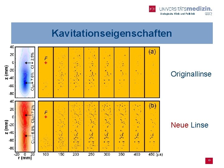 Urologische Klinik und Poliklinik Kavitationseigenschaften Originallinse Neue Linse 13 