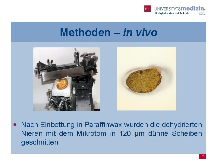 Urologische Klinik und Poliklinik Methoden – in vivo § Nach Einbettung in Paraffinwax wurden