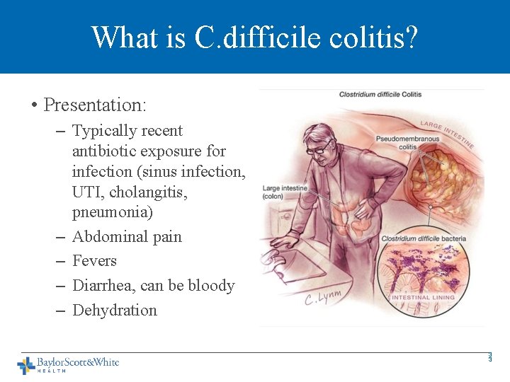What is C. difficile colitis? • Presentation: – Typically recent antibiotic exposure for infection