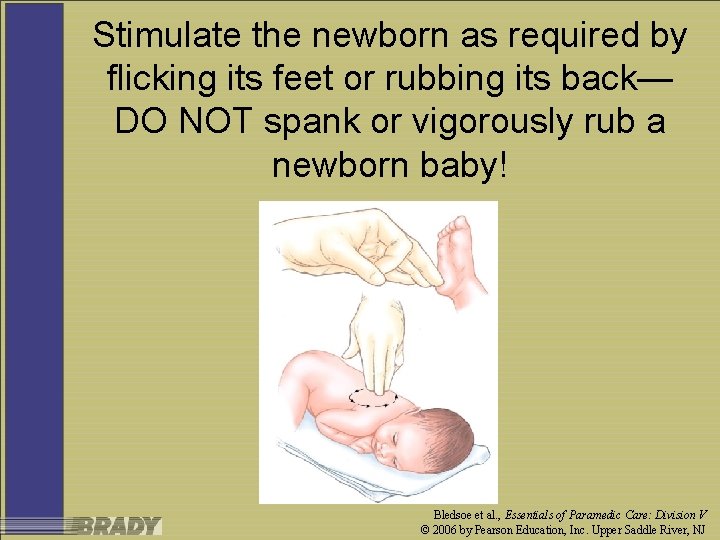 Stimulate the newborn as required by flicking its feet or rubbing its back— DO