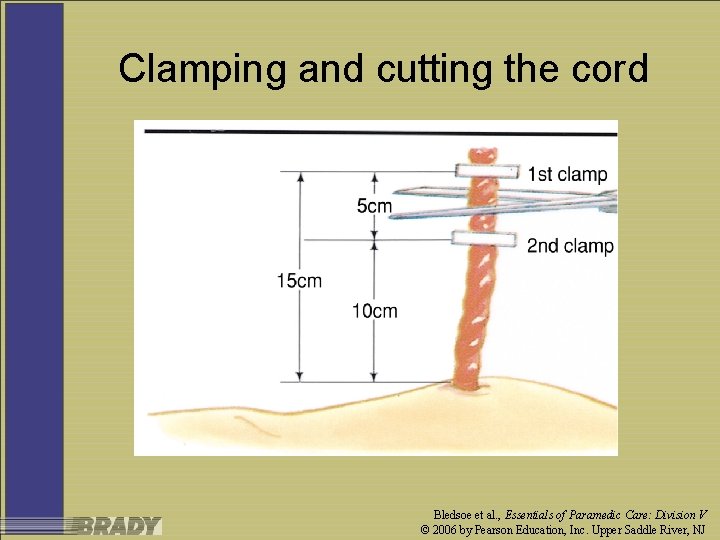 Clamping and cutting the cord Bledsoe et al. , Essentials of Paramedic Care: Division