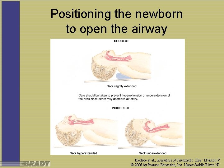 Positioning the newborn to open the airway Bledsoe et al. , Essentials of Paramedic