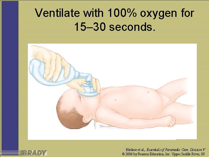 Ventilate with 100% oxygen for 15– 30 seconds. Bledsoe et al. , Essentials of