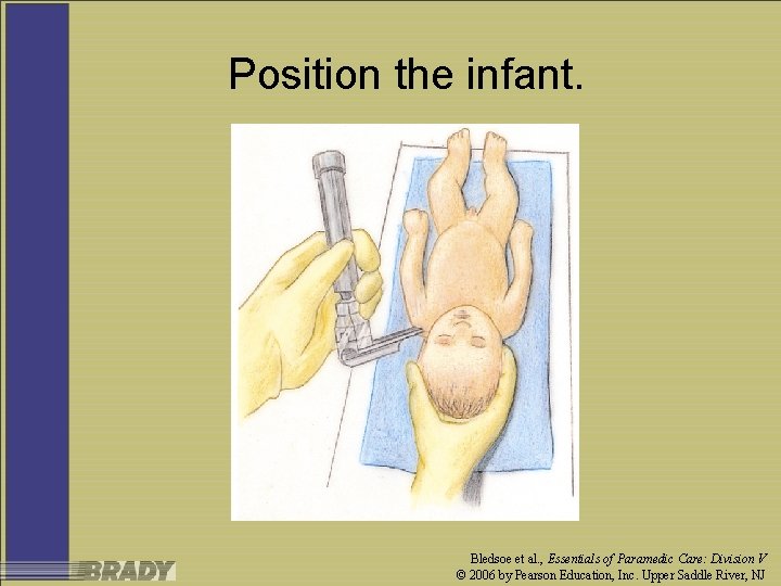 Position the infant. Bledsoe et al. , Essentials of Paramedic Care: Division V ©