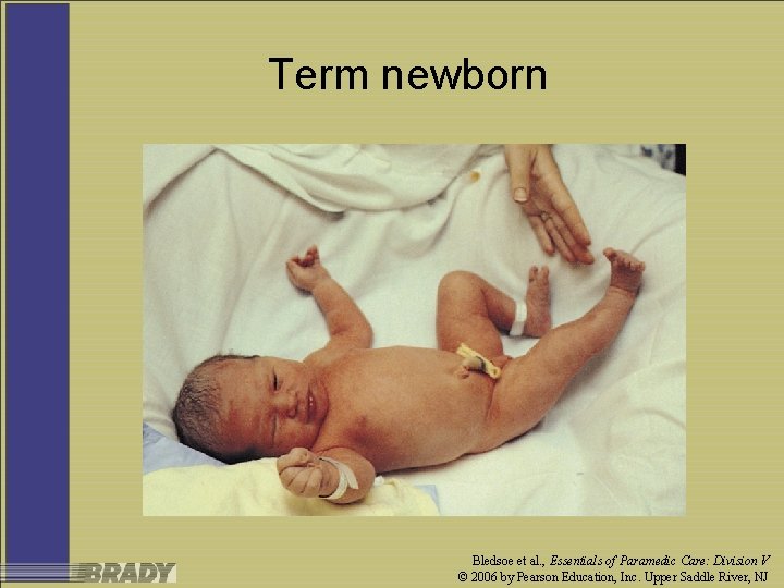Term newborn Bledsoe et al. , Essentials of Paramedic Care: Division V © 2006