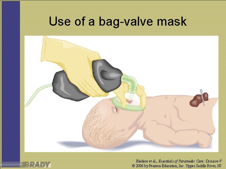 Use of a bag-valve mask Bledsoe et al. , Essentials of Paramedic Care: Division