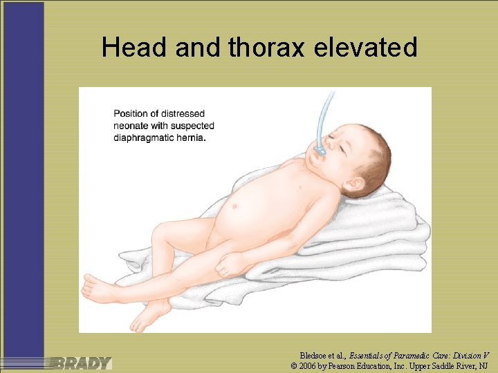 Head and thorax elevated Bledsoe et al. , Essentials of Paramedic Care: Division V