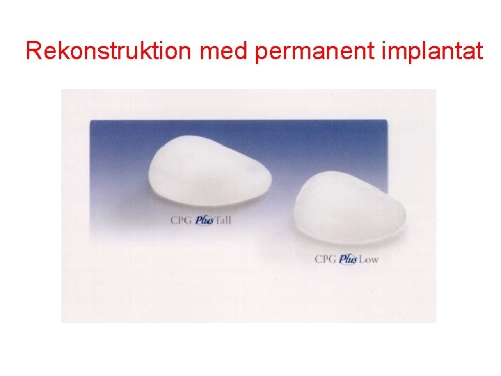 Rekonstruktion med permanent implantat 