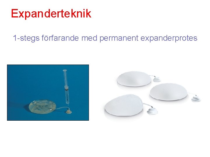 Expanderteknik 1 -stegs förfarande med permanent expanderprotes 