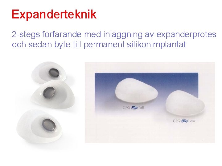 Expanderteknik 2 -stegs förfarande med inläggning av expanderprotes och sedan byte till permanent silikonimplantat